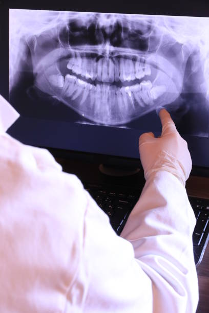 Best Emergency Dental Extractions in Altamont, TN