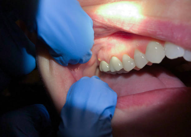 Best Weekend Emergency Dentist in Altamont, TN