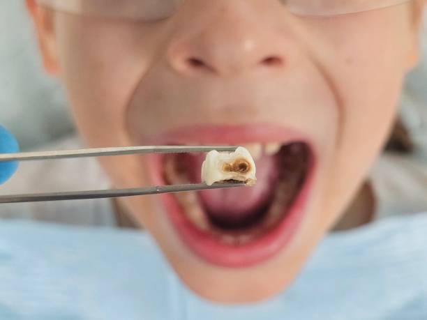 Best Emergency Dental Services for Seniors in Altamont, TN