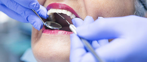 Best Emergency Dentist for Lost Fillings or Crowns in Altamont, TN